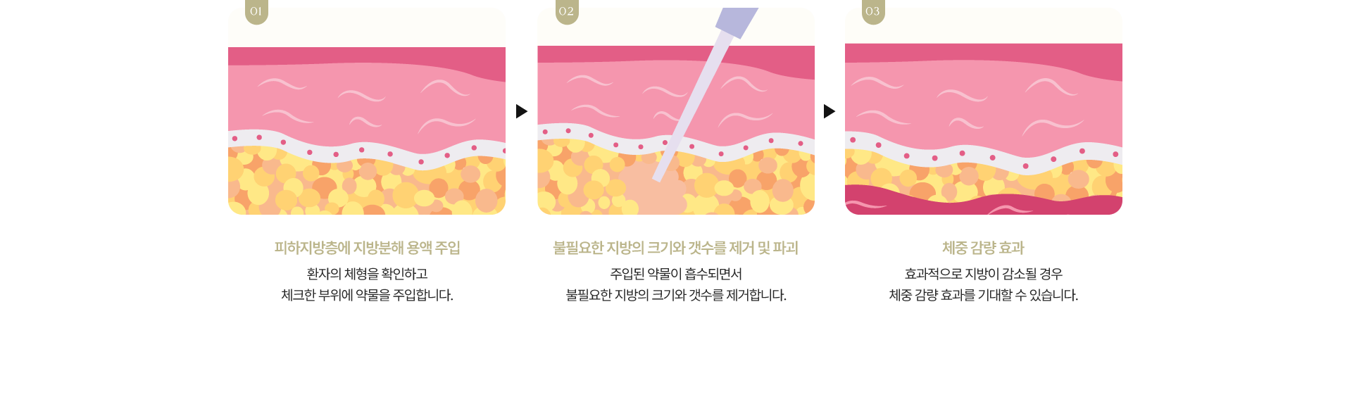 지방분해주사 시술 원리